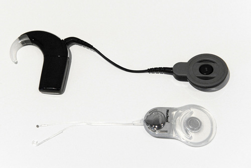 Kokleaimplantat